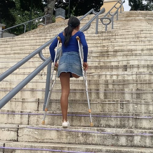 KEILA AMPUTEE: Stars don't like stairs
